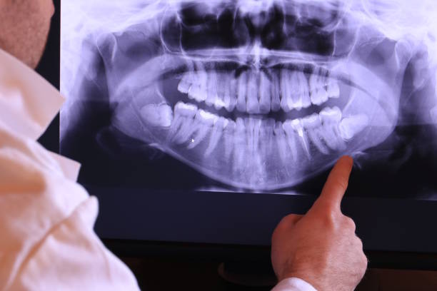 Best Emergency Tooth Extraction  in Memphis, FL