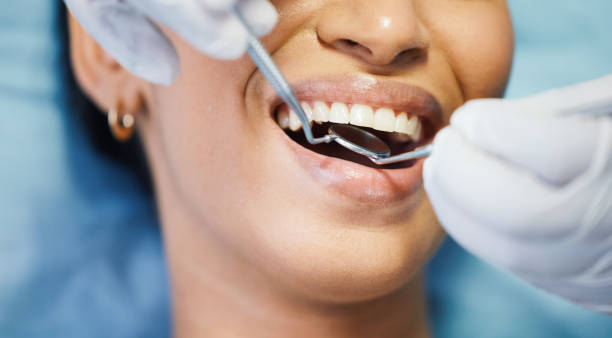 Best Teeth Whitening  in Memphis, FL